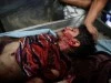 list of 195 people killed in Gaza bloodhsed