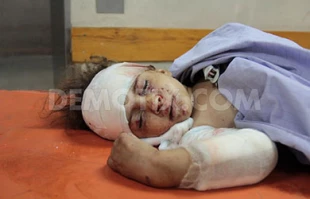 UN: Nearly 300 Palestinian children killed in Gaza
