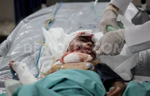 UN: Nearly 300 Palestinian children killed in Gaza