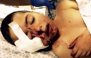 Israeli forces shoot at 5-year-old's face