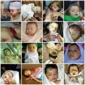 Children account for 66pc of victims Gaza massacre