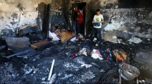 Calls in air for appropriate response to toddler’s burning