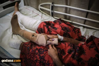 همراه با تصاویر/

جوان فلسطینی که دوبار پایش را از دست داد