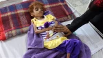 UN warns 12mn Yemenis may face worst famine in 100 years 2