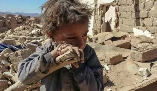 جمعية الاطباء الايرانيين تدعو منظمة الصحة العالمية لدعم الشعب اليمني