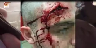 یک هفته پیش در مرزهای شرقی غزه رخ داد:

گروهان‌های قدس فیلم عملیات هدف قرار دادن نظامی صهیونیست را منتشر کرد+ تصاویر و فیلم 5