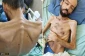 Lawyer: Palestinian captive in terrible health condition after 169 days of hunger strike