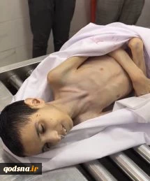 Gaza: Infant and 20-year-old woman die of starvation