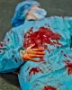همبستگی نروژی ها در اسلو با کادر درمان، و کودکان و خبرنگاران به شهادت رسیده در جریان نسل‌کشی در نوار غزه 
 3