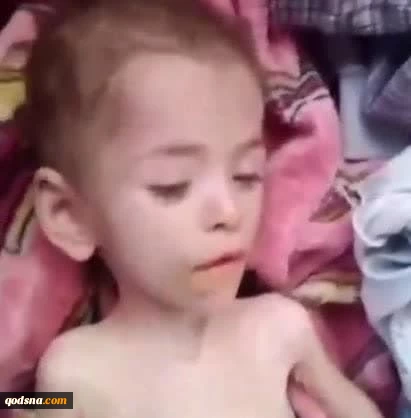 کودک چهار ساله، یحیی زکریا ابو حلیمه، از کودکان دارای نیازهای ویژه، بر اثر سوءتغذیه ناشی از تداوم محاصره و بسته بودن گذرگاه‌های نوار غزه جان باخت 2
