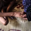 رنج کودکانه در سایه محاصره؛ «نجوی حجاج» قربانی سوءتغذیه و بیماری‌های پوستی در غزه 2
