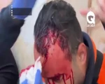 حمله صهیونیست ها به خبرنگاران و امدادگران فلسطینی در مسجد الاقصی